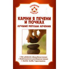 Камни в печени и почках. Лучшие методы лечения. П.Н. Мишинькин